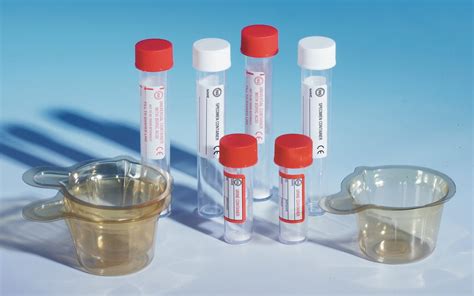 red bottle urine test|best container for urine sample.